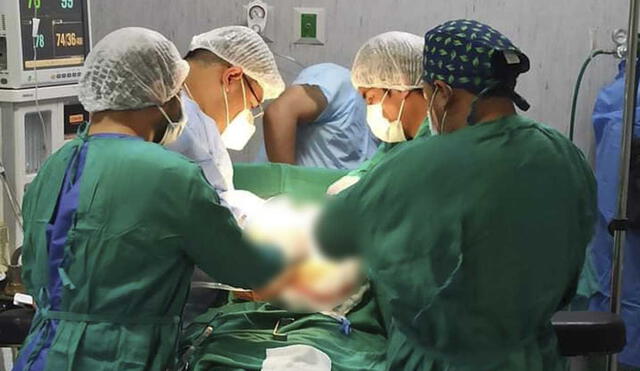 Por primera vez se realizó este tipo de cirugía en nosocomio. Foto: Geresa Cusco