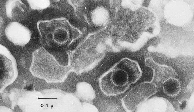 Imagen de microscopio electrónico muestra tres partículas del virus de Epstein-Barr (VEB), cuya estructura es circular. Foto: Liza Gross