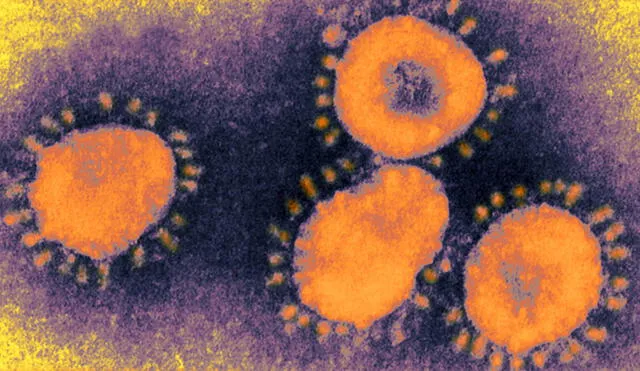 Partículas de un coronavirus que infecta a humanos. Foto: microscope.com