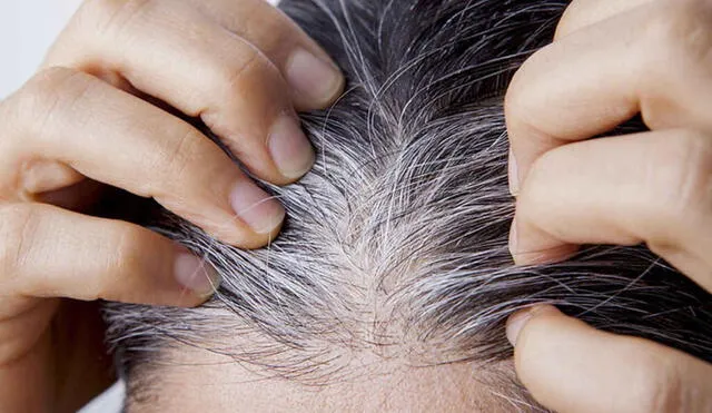 El estudio sobre los cambios de color en el cabello fue aprobado por el Instituto Psiquiátrico del Estado de Nueva York. Foto: difusión