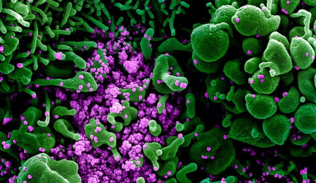 Micrografía electrónica de barrido coloreada de una célula apoptótica (verde) muy infectada con partículas del virus SARS-COV-2 (púrpura). Foto: NIAID
