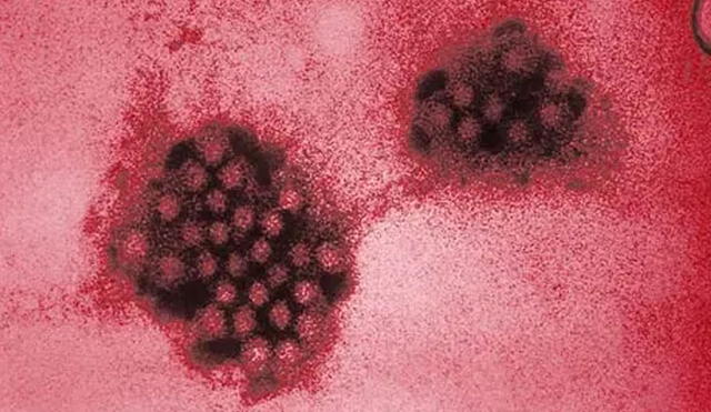 Imagen de microscopio electrónico muestra partículas de norovirus aisladas de un paciente infectado. Foto: CDC
