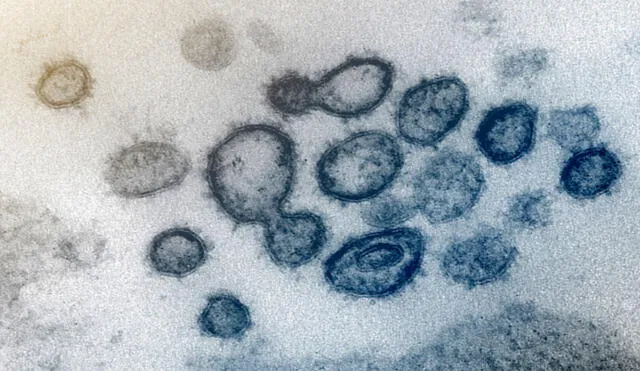 Esta imagen de microscopio electrónico de transmisión muestra SARS-CoV-2. Foto: NIAID-RML