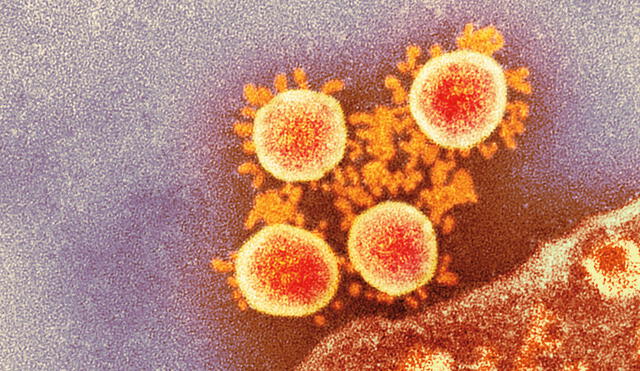 Micrografía electrónica de transmisión (TEM) coloreada de partículas de coronavirus SARS-CoV-2. Foto: Servicio Nacional de Infecciones / SCI.