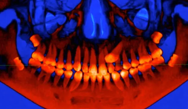 Pese a que los genes que determinan el tamaño de nuestra mandíbula cambiaron durante la línea evolutiva del ser humano, aquellos que definen cuántos dientes tenemos no varió. Foto: Denver Marchoiri/ University of Saskatchewan