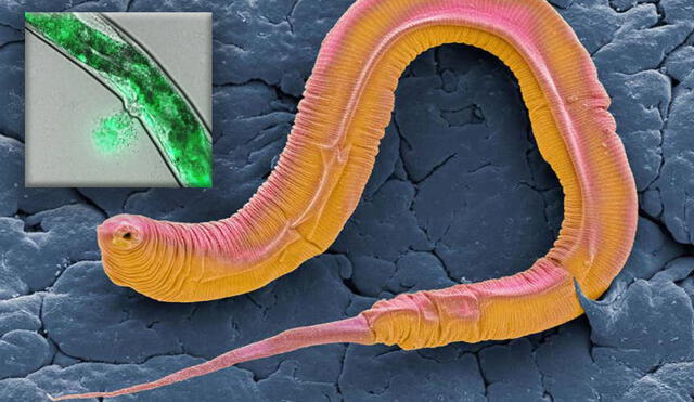 El gusano redondo C. elegans se destruye a sí mismo para transferir nutrientes a su descendencia. Foto: Science Photo Library/Alamy / UCL