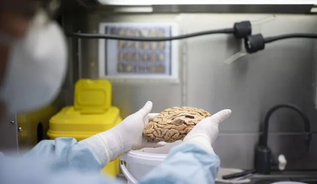 Un investigador sostiene uno de los cerebros del banco de la fundación Cien. Foto: El País