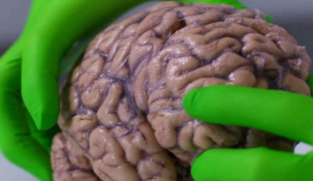 El cerebro humano ha ido cambiando de tamaño conforme pasan los siglos. Foto: BBC
