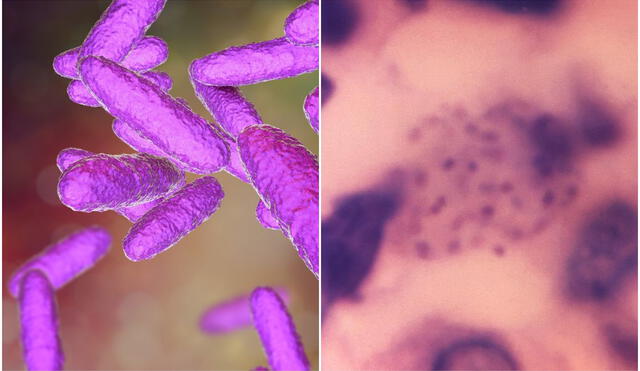 Esta infección, también llamada granuloma inguinal, es causada por la bacteria ‘klebsiella granulomatis’. Foto: composición