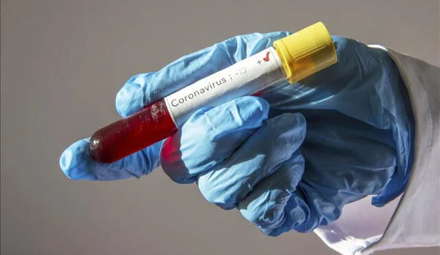 Personas infectadas y vacunadas contra la COVID-19 tienen menor probabilidad de contagiar a otras. Foto: Agencia Anadolu