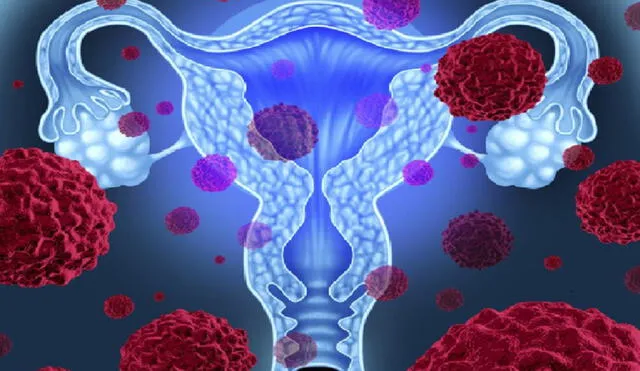 El virus del papiloma humano (VPH) representa el 5% de cánceres de todo el mundo. Tanto hombres como mujeres sufren del riesgo. Foto: AP Images