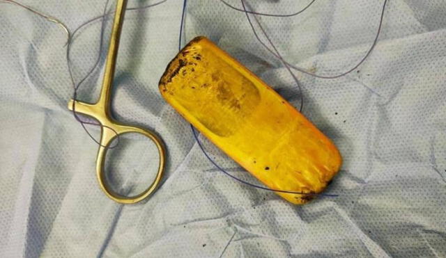 Los doctores descubrieron un objeto extraño en los intestinos del preso. Foto: Sky News Arabia