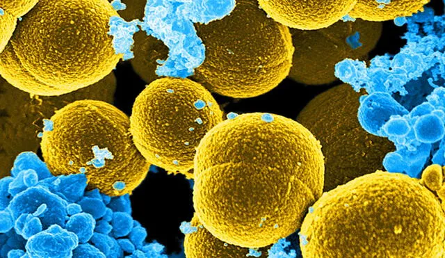 Imagen de microscopia electrónica digitalmente colorida que muestra bacterias Staphylococcus. Foto: referencial / Instituto Nacional de Alergias y Enfermedades Infecciosas (NIAID)
