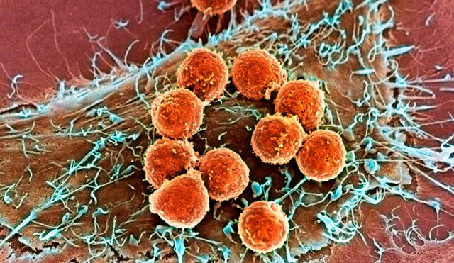 Los investigadores creen que los linfocitos T asesinos podrían jugar un papel clave en la eliminación del VIH. Foto: mskcc.org