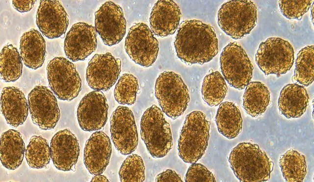 Células beta secretoras de insulina humana bajo el microscopio. Foto: Laboratorio Millman