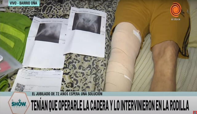 En Argentina no han dudado en calificarlo como un caso inaudito. Foto: captura de LagartoShowOk / YouTube