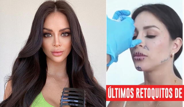 Sheyla Rojas habló del último tratamiento estético que se hizo en el rostro. Foto: Instagram / América TV