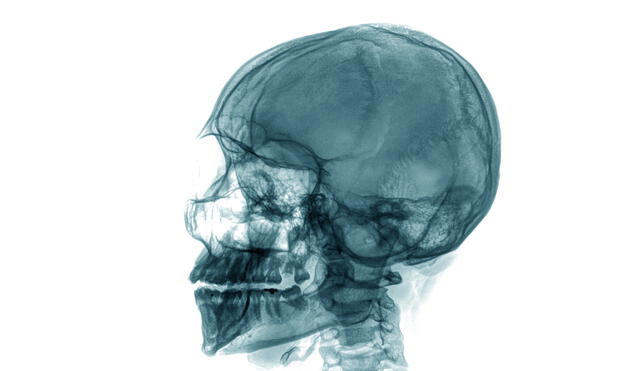 Visión en rayos X de un cráneo humano. Foto: referencial/Adobe Stock