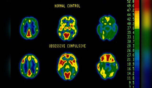 El trastorno compulsivo genera pensamientos intrusivos que derivan en una obsesión que puede afectar significativamente la vida diaria. Foto: Yale School of Medicine