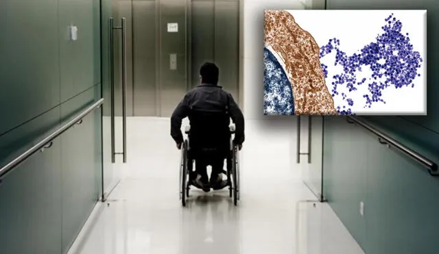 Un paciente de esclerosis múltiple postrado en silla de ruedas. A la derecha, el virus de Epstein-Barr, que se muestra emergiendo de una célula B. Foto: composición/Pedro Madueño/Steve Gschmeissner