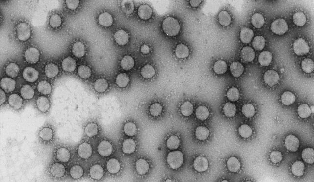 El monitoreo de nuevos virus, como el coronavirus SARS-CoV-2, es una tarea constante para prepararse ante una futura pandemia. Foto: NCB - CSIS