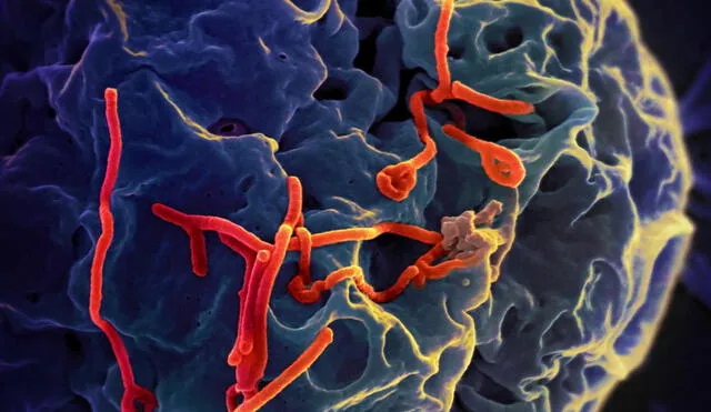 Desde 1976, los brotes del virus del ébola han sembrado gran preocupación en el mundo debido a su alta tasa de mortalidad. Foto: NIAID