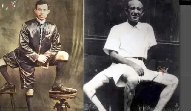 En 1889, nació un pequeño de nombre Francesco Lentini, pero con el pasar de los años sería recordado por ser el hombre que llegó al mundo con 2 penes y 3 piernas