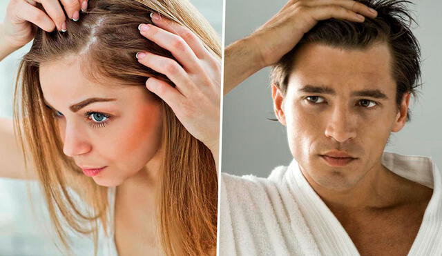 Millones de hombres y mujeres en el mundo enfrentan problemas por la caída de cabello. Foto: composición de Gerson Cardoso / La República