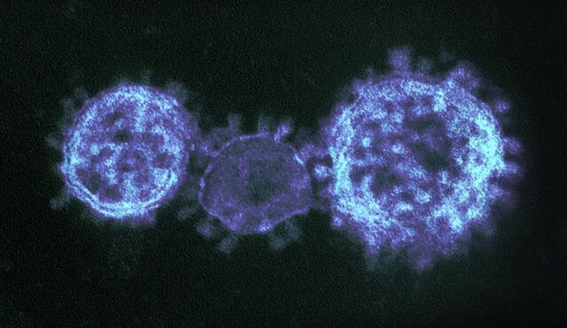 El coronavirus SARS-CoV-2 posee una capacidad para volverse indetectable ante la respuesta inmune humana. Foto: NIAID