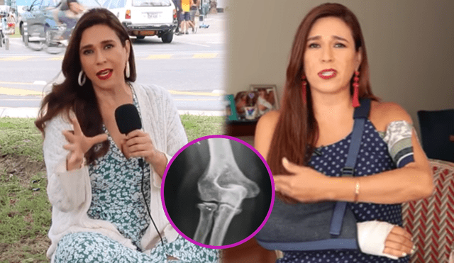 Verónica Linares recordó que no es la primera vez que sufre una caída en el parque en el que se accidentó el brazo. Foto: composición/Verónica Linares/Instagram/YouTube