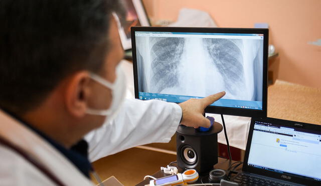 Científicos detectaron la enfermedad de las vías respiratorias pequeñas en pacientes con COVID-19 persistente. Foto: referencial / AFP