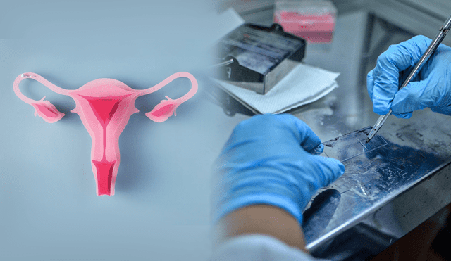 Cada cinco horas muere una mujer a causa del cáncer del cuello uterino, según el último estudio elaborado por The Global Cancer. Foto: composición/Jazmín Ceras