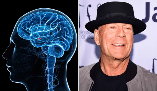 Los familiares de Bruce Willis dieron a conocer el diagnostico del actor el último 30 de marzo a través de una publicación de Instagram. Foto: composición AFP
