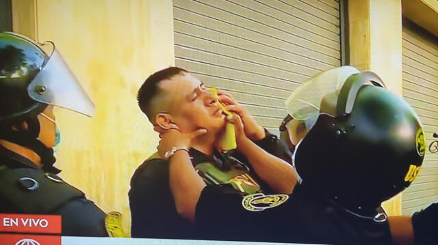 Policía resulta herido tras ser impactado por una piedra en el rostro. Foto: captura América Noticias