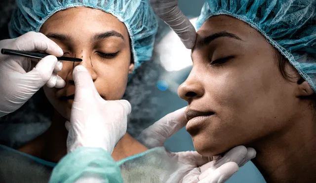 La rinoplastia es una cirugía plástica que modifica el tamaño, forma y proporción de la nariz por estética y concordancia con los rasgos faciales. Foto: composición LR/Gerson Cardozo