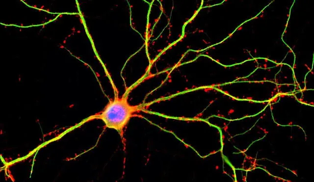 El párkinson es una enfermedad neurodegenerativa que todavía no goza de un tratamiento eficaz. Foto: Shelley Halpain / UC San Diego
