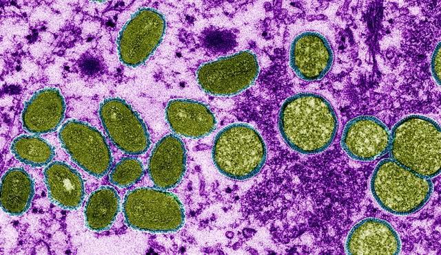 Muestra del virus de la viruela mono (monkeypox, en inglés) bajo el lente de un microscopio electrónico. Foto: CDC / Cynthia S. Goldsmith / Science