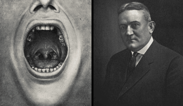 lustración de una boca con dientes extraídos del libro de Cotton. Foto: Composición LR/Wikipedia.