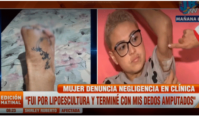 La afectada señaló que el doctor Juan David Córdova cometió negligencia médica y ahora evade su responsabilidad. Video: ATV