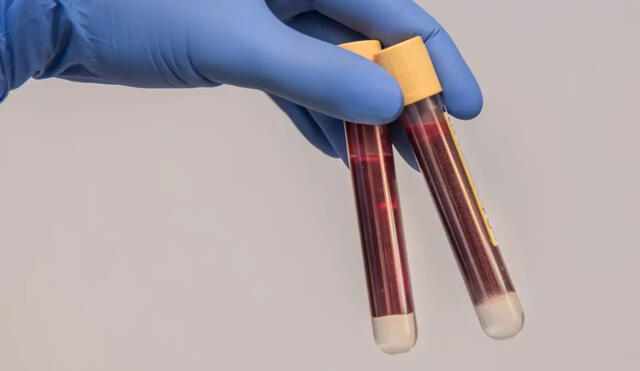 La sangre de tipo RH nula, también llamada "sangre dorada", solo ha sido detectada en 45 personas desde su descubrimiento en la década de 1960. Foto: Pixabay