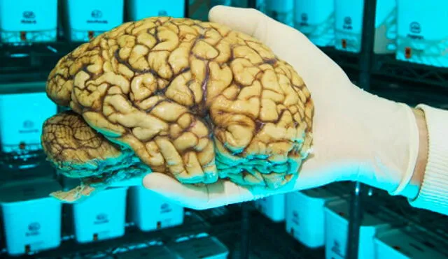 Los estudios realizados revelaron que el cerebro de John Gacy no presentaba anormalidades. Foto: BBC