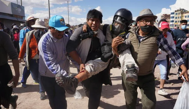 La herida a Aldair Mejía, producto de la represión policial indiscriminada, provocó la fractura del hueso de su pierna derecha. Foto: EFE