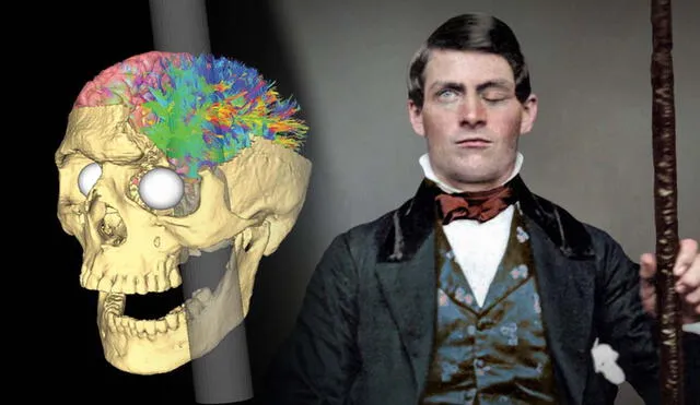 El accidente de Phineas Gage causó una serie de estudios neurológicos. Foto: composición LR/CNN/Atresplayer