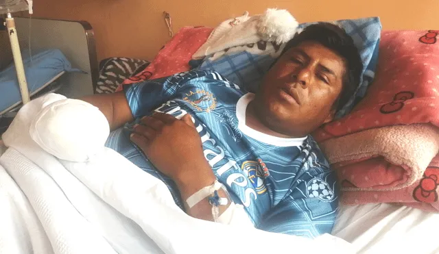 Perdió la mano. Silva se recupera en hospital de Juliaca. Foto: La República.