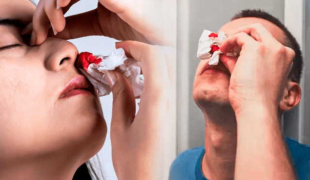 Es común que la nariz te empiece a sangrar debido a resfriados o irritaciones. Foto: composición LR/Salud180