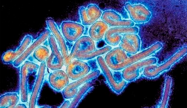Según la directora regional de la OMS para África, el virus de Marburgo "es altamente infeccioso". Foto: Universidad de Texas Medical Branc