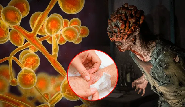 Los hongos presentan síntomas similares a los de una infección bacteriana. Foto: composición LR/HBO Max/BBC