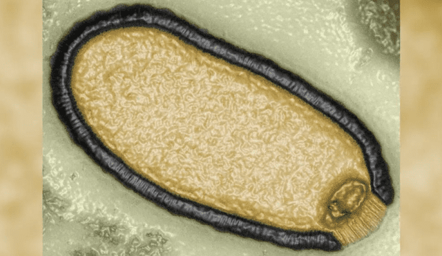 Microfotografía de la muestra de un virus aislado del permafrost con un periodo de vida de 30.000 años y que fue revivido por Claverie, en 2014. Foto: CNN
