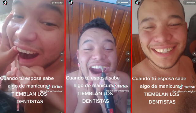 Varios dentistas comentaron la publicación y lo tomaron con humor. Foto: captura TikTok/emilianohuedyluc