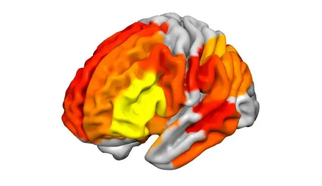 La hiperconectividad más potente (más amarillo) se registró en las áreas del cerebro con las funciones más evolucionadas (imaginación, lenguaje, etc.). Imagen: Imperial College London